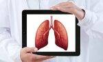 肺部健康的4种自测及养护方法