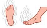 脚气的各种症状及正确治疗方法