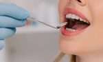 牙龈出血、蛀牙、假牙等牙齿健康问题解答