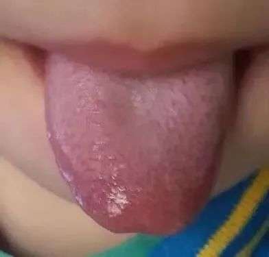 有寒的舌苔