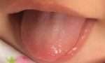 16张舌头照教你如何通过舌头看身体健康状况