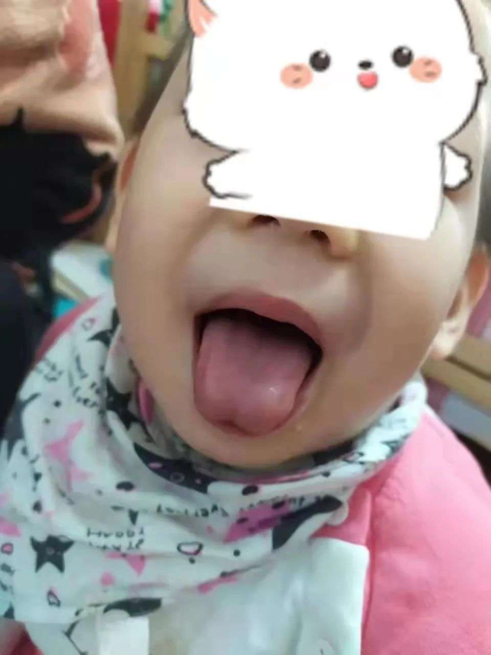 小孩舌苔