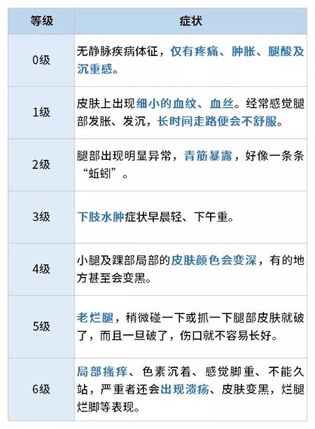 下肢静脉曲张的7个等级