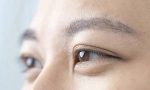 关于眼科检查、眼部疾病等眼睛健康知识