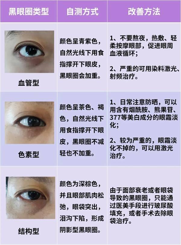 消除黑眼圈的正确做法
