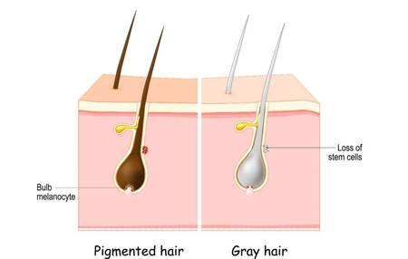 头发变白原因