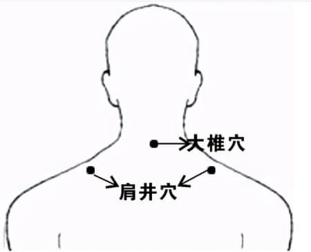 大椎穴、肩井穴