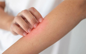 常见皮肤瘙痒的原因及治疗方法
