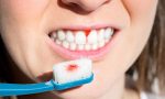 如何预防和治疗牙龈炎