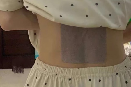 远红外理疗贴对腰椎间盘突出有用吗