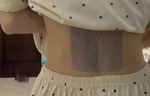 远红外理疗贴对腰椎间盘突出有用吗